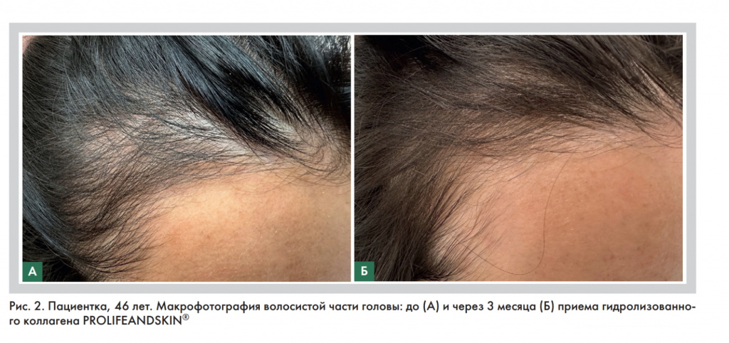 Рис 2 на сайт.jpg