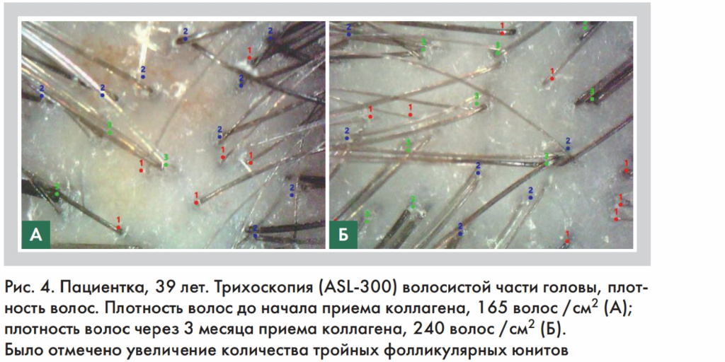 Рис 4 на сайт.jpg