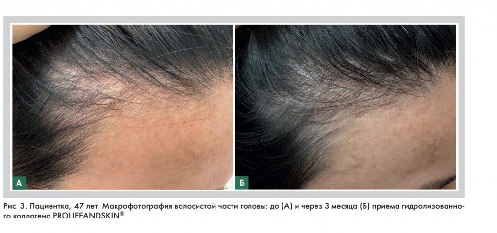 Рис 3 на сайт.jpg